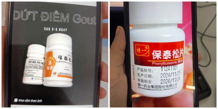 Dùng thuốc trị gout Phenylbutazone đã bị cấm, nhiều người nhập viện - Ảnh 1. Phenylbutazone - Ảnh 1.