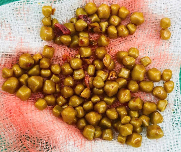 cấp cứu - Ảnh 1.