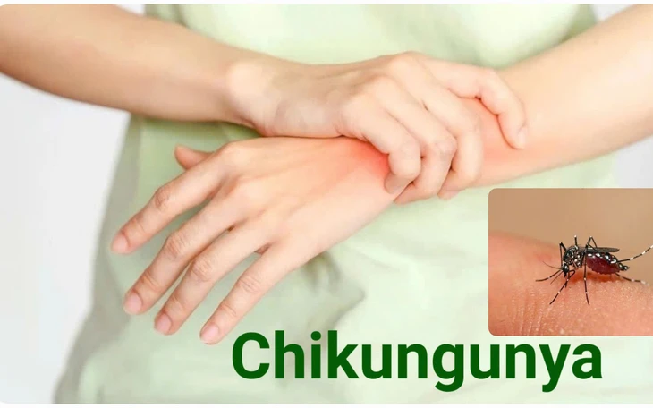 Thực hư chuyện kiến giúp xua đuổi muỗi truyền bệnh chikungunya - Ảnh 2.