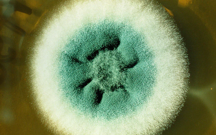 Pháp lần đầu phát hiện virus Shamonda ở người, bệnh nhân đã tử vong - Ảnh 2.