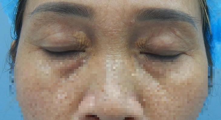 Mí mắt - Ảnh 1.