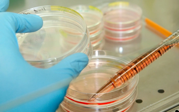 Lần đầu tiên ghép tủy từ mẹ ruột cho bệnh nhi Thalassemia thành công - Ảnh 2.