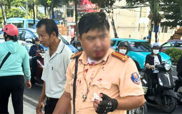 Đang làm nhiệm vụ, trung tá cảnh sát giao thông bị người đàn ông nước ngoài đấm vào miệng - Ảnh 1.