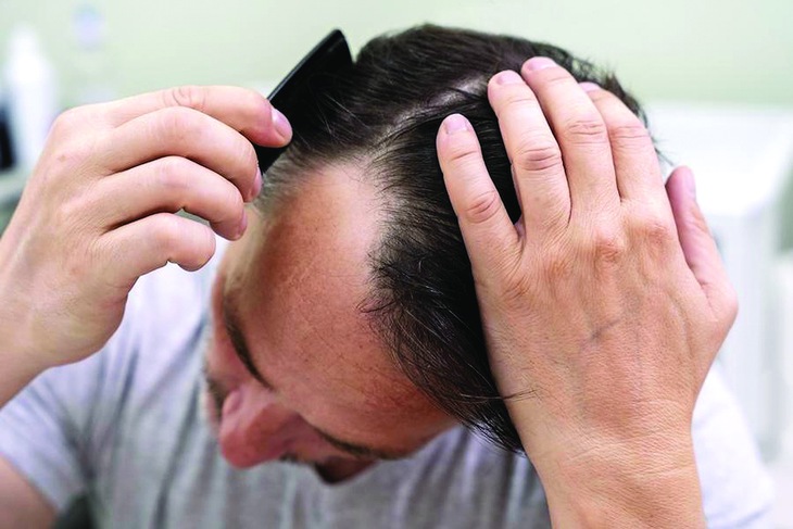 Phẫu thuật thẩm mỹ: "liều thuốc" tự tin mới của đàn ông - Ảnh 4.