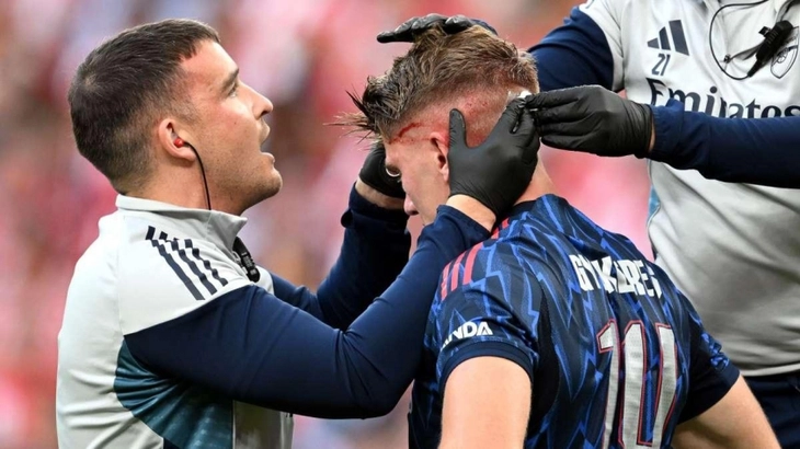 Gyokeres đổ máu trong chiến thắng của Arsenal - Ảnh 1.