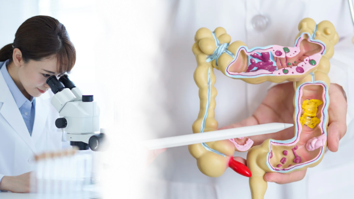 Phương pháp mới phát hiện 90% ca ung thư đại trực tràng không cần nội soi - Ảnh 1.