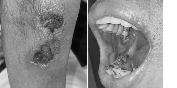 Uống sai liều thuốc da liễu, nhiều người ngộ độc nặng - Ảnh 1.