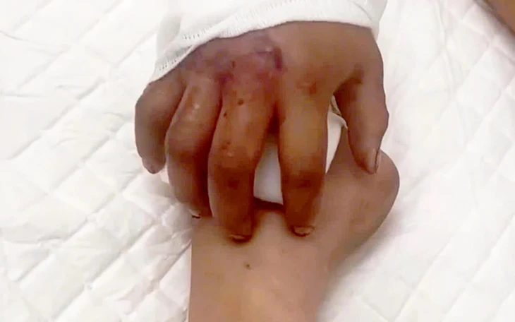 Cứu gương mặt bị dập nát cho người đàn ông bước hụt xuống hố thang máy - Ảnh 2.