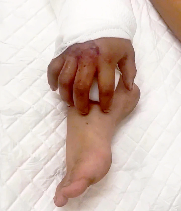 Độc đáo kỹ thuật 'nuôi chi' tái tạo cơ thể - Ảnh 2.