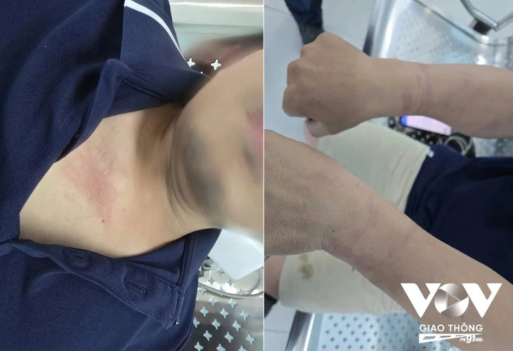 Lãnh đạo VOV Giao thông: 'Việc còng tay phóng viên đang tác nghiệp là bất thường' - Ảnh 1.