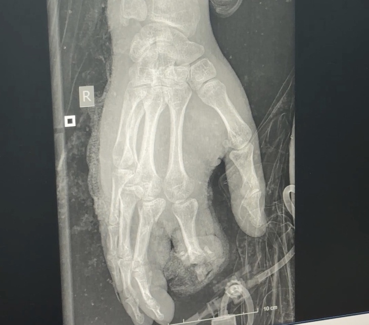 pháo nổ - Ảnh 2.