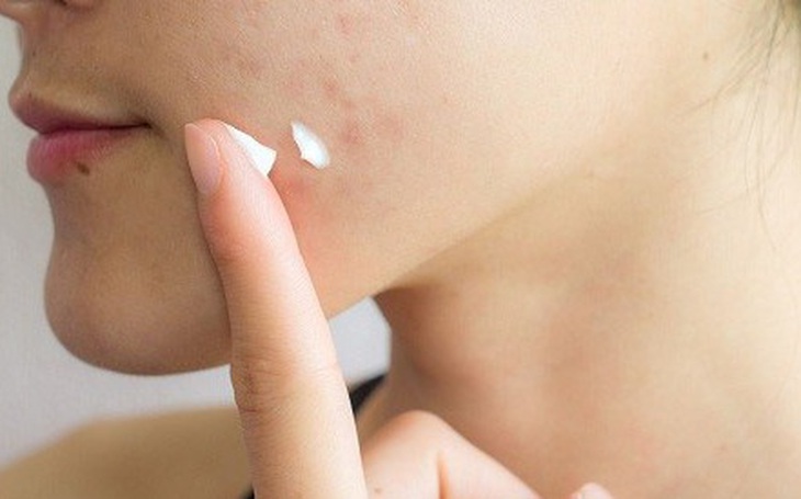 Thu hồi toàn quốc lô sữa sửa mặt Acnes, sữa rửa tay Kleen hương trà xanh vi phạm - Ảnh 2.