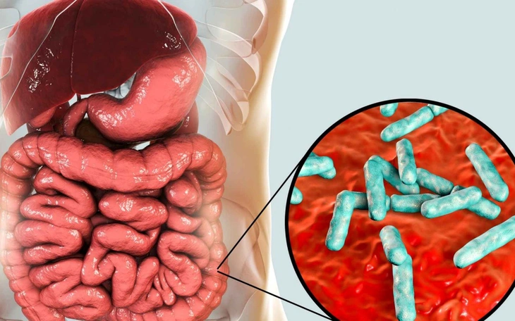 Tại sao phụ nữ thường đau đường ruột nặng hơn nam giới? - Ảnh 2.