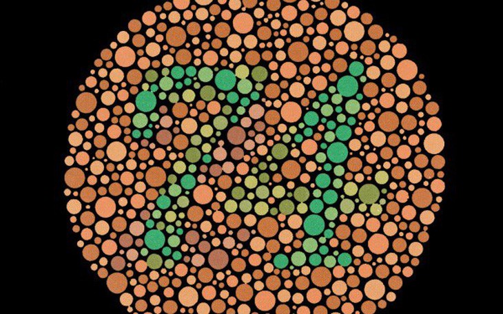 Điều gì thực sự quyết định màu mắt một người?  - Ảnh 2.