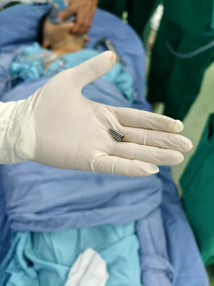 hóc đầu ngòi bút - Ảnh 2.