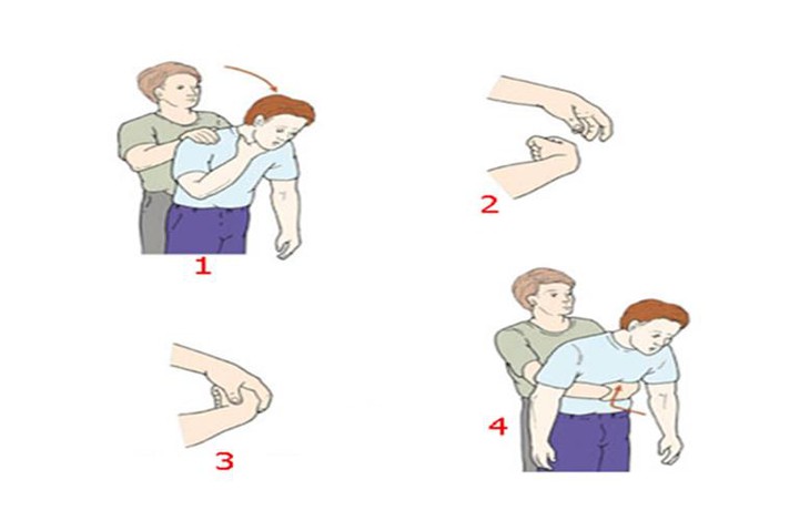 Trẻ dễ bị hóc đầu ngòi bút, nhận biết và xử trí ra sao? - Ảnh 4.
