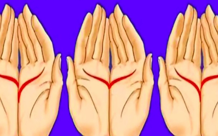 Thử tài IQ: Di chuyển một que diêm để 7-10=9 thành phép tính đúng - Ảnh 7.