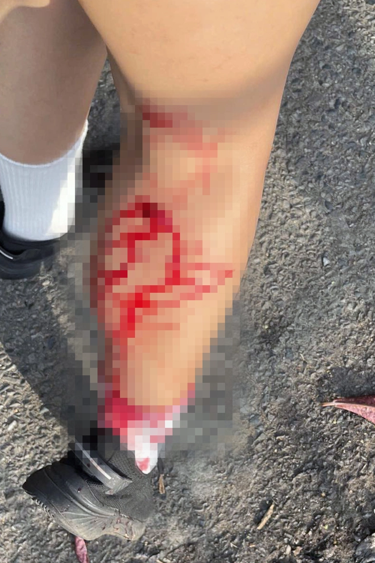 Khỉ hoang rượt đuổi, cắn người chạy bộ ở Vũng Tàu - Ảnh 1.