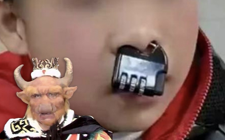 Người phụ nữ 'mọc' thêm bầu ngực thứ ba sau sinh ở nách - Ảnh 3.