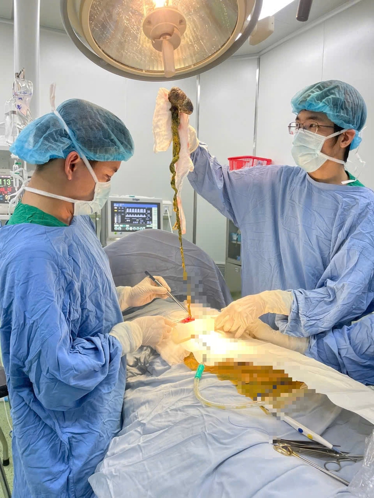 búi tóc - Ảnh 1.