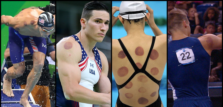 Vì sao giới VĐV phương Tây mê mẩn giác hơi của Trung Quốc? - Ảnh 3.