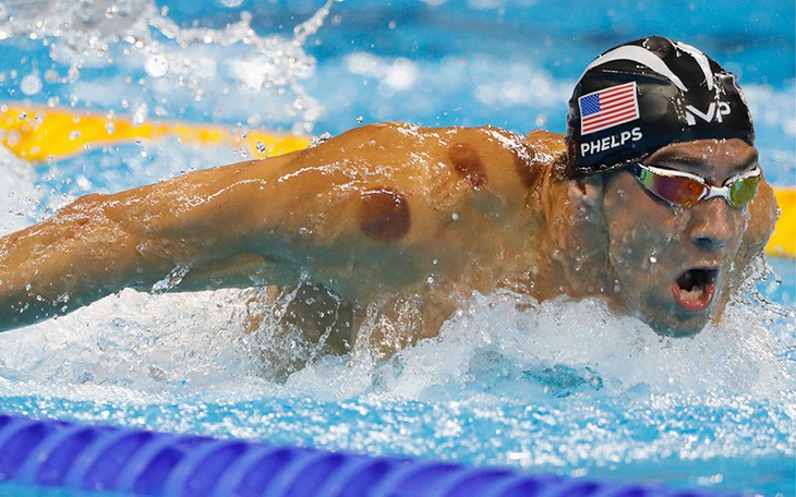 Những môn thể thao có tỉ lệ đột quỵ cao - Ảnh 2.