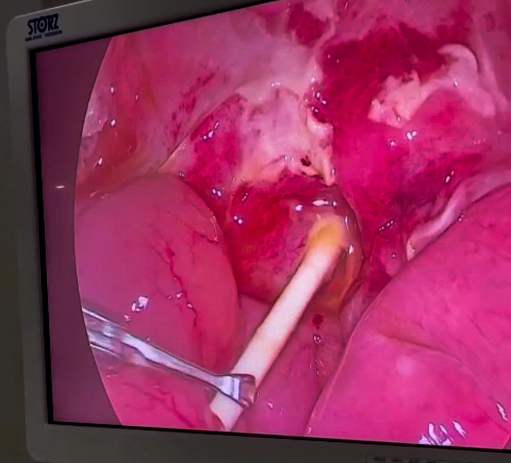 bệnh nhi - Ảnh 2.