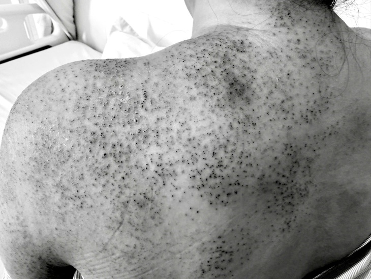 chích lể - Ảnh 2.