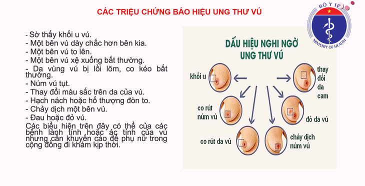 5 loại ung thư người Việt mắc phải nhiều nhất: Ung thư vú dẫn đầu, tiếp theo là gì? - Ảnh 3.