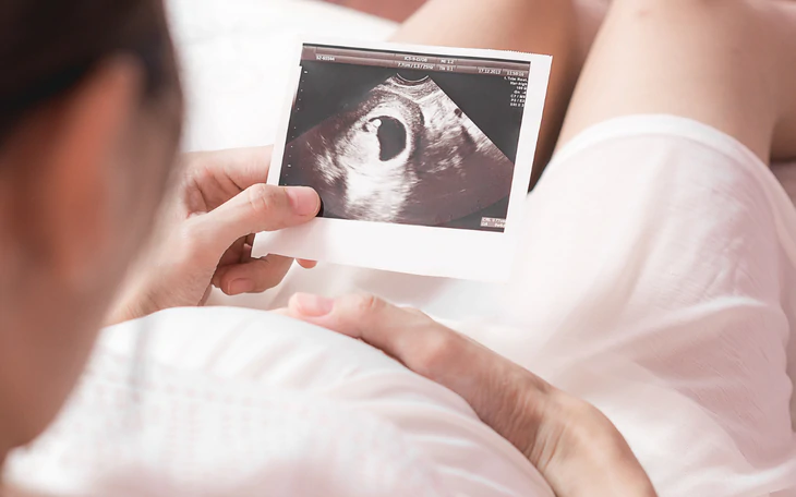 Hai chính sách Cần Thơ đang tính toán để người trẻ an cư, sinh con - Ảnh 3.