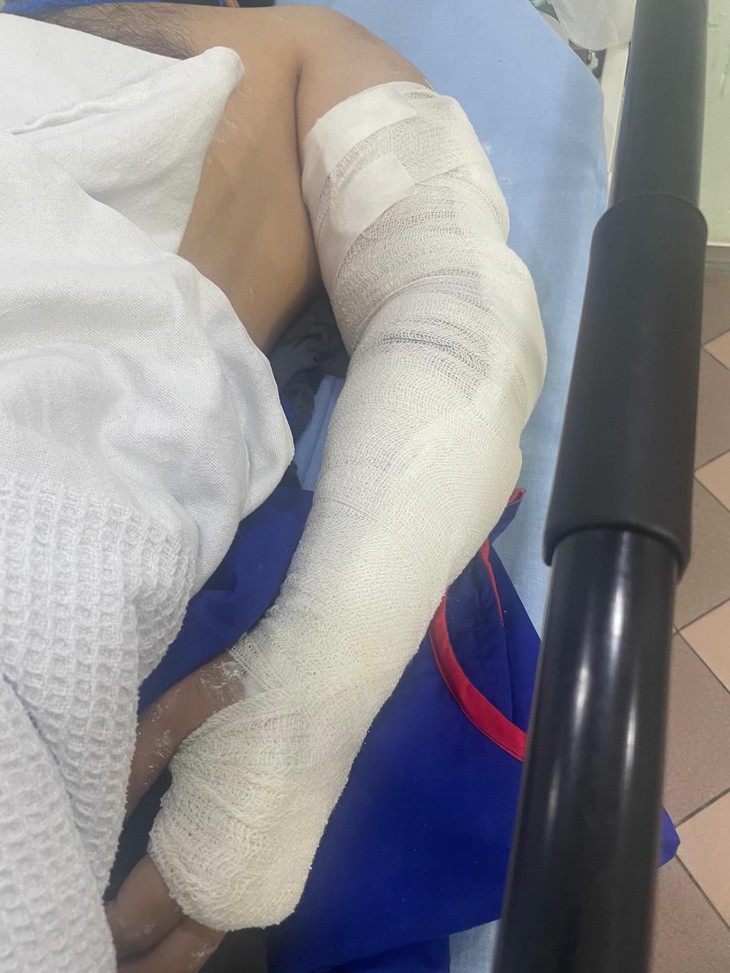 mở cửa ô tô - Ảnh 2.