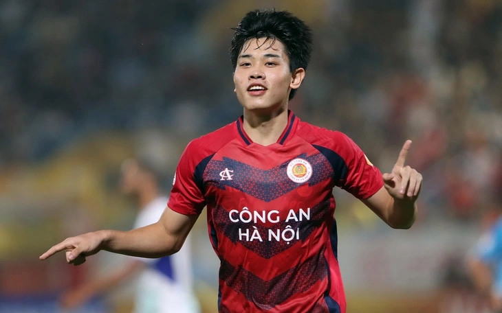 Thủ môn đốt lưới nhà 'dị' nhất lịch sử, khiến HLV bay ghế ngay sau trận đấu - Ảnh 2.