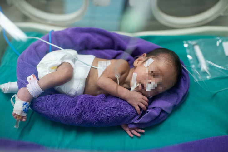 Những sinh linh bé nhỏ bắt đầu cuộc đời bằng một cuộc chiến - Ảnh 4. Những sinh linh bé nhỏ bắt đầu cuộc đời bằng một cuộc chiến - Ảnh 4.