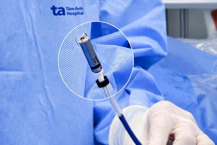 Bệnh viện đầu tiên tại Việt Nam cấy máy tạo nhịp không dây thế hệ mới - Ảnh 2.