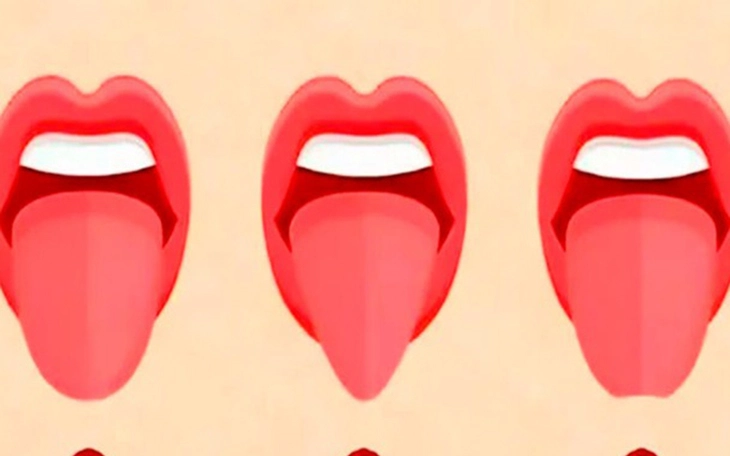 Quiz: Một lựa chọn nhỏ, phản chiếu áp lực lớn trong bạn - Ảnh 5.