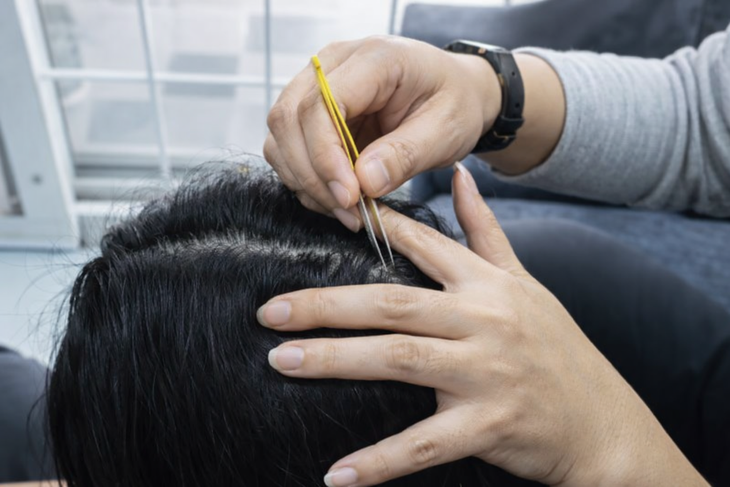 Nhổ tóc bạc cho 'đỡ ngứa mắt', coi chừng tóc không mọc lại - Ảnh 1.