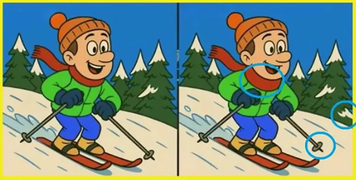 Mắt cú vọ - Ảnh 7.