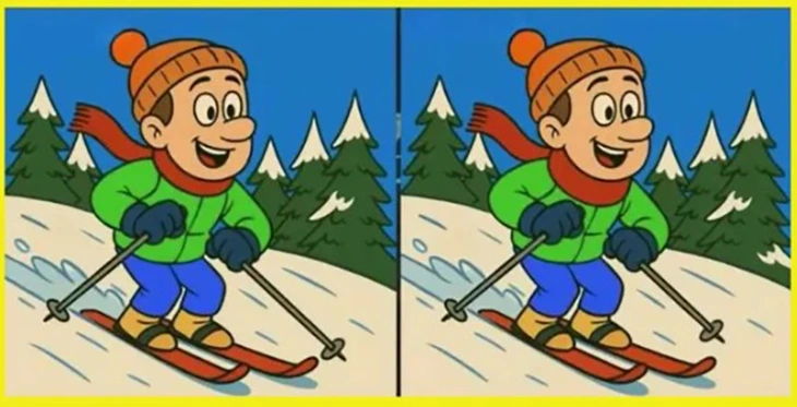 Mắt cú vọ - Ảnh 6.