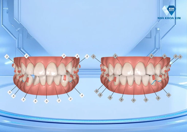 Nha khoa Kim - Ảnh 3.