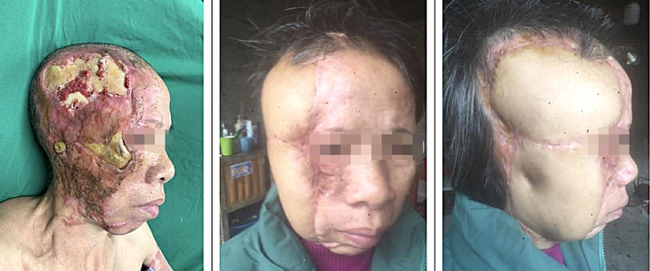 vi phẫu - Ảnh 4.