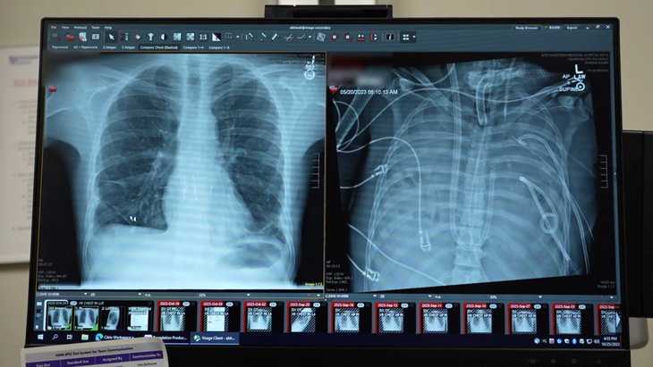  Sống sót 48 giờ không cần phổi  - Ảnh 1.