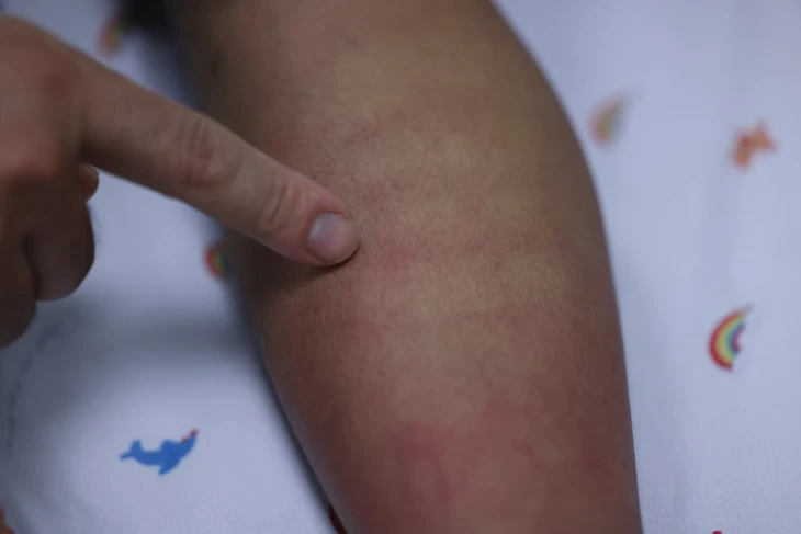 Sốt xuất huyết Dengue và những dự định dở dang bên giường bệnh - Ảnh 2.