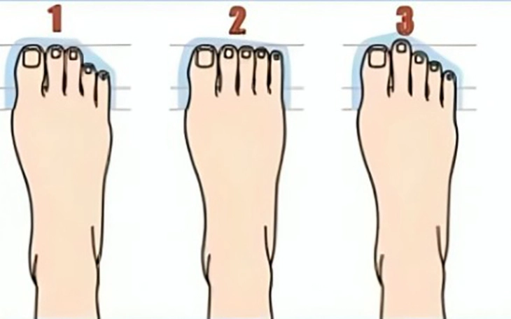 Quiz: Cách ăn dưa hấu tiết lộ kỹ năng tư duy tiềm ẩn của bạn - Ảnh 3.