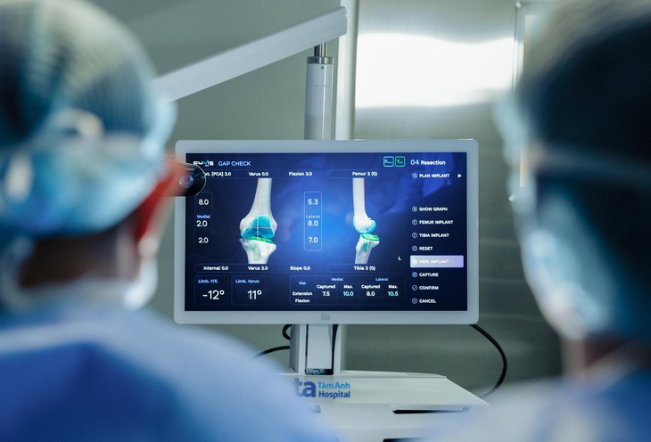 Robot thay khớp chủ động đầu tiên tại Việt Nam - Ảnh 4.