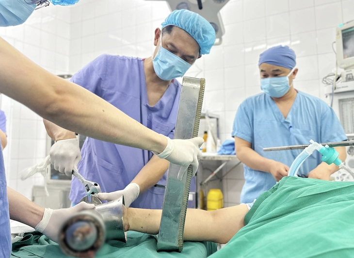 Kẹt nguyên bàn tay trong máy xay thịt, người phụ nữ phải phẫu thuật cắt cụt chi - Ảnh 2. máy xay thịt - Ảnh 2.