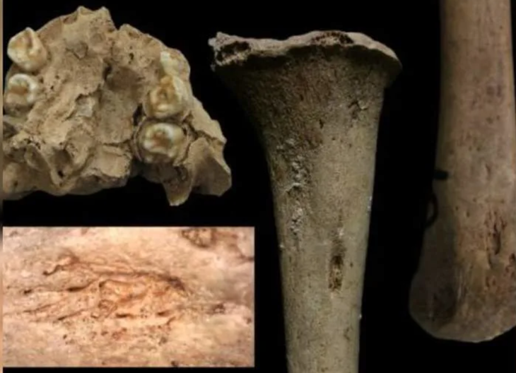 giang mai - Ảnh 1.