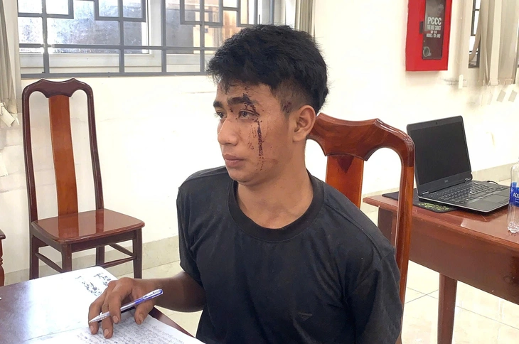 trộm ô tô - Ảnh 2.