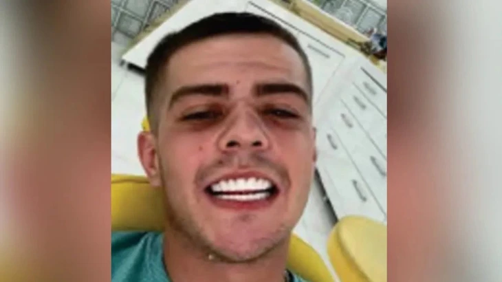 Tên tội phạm bị bắt vì khoe răng 'sáng như quảng cáo' - Ảnh 1.