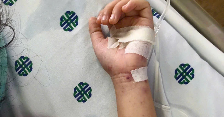 Bệnh Não mô cầu, đừng chờ nổi ban mới đi viện - Ảnh 1.