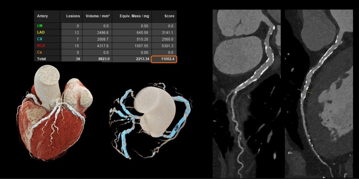 Cắt lớp vi tính - Ảnh 2.